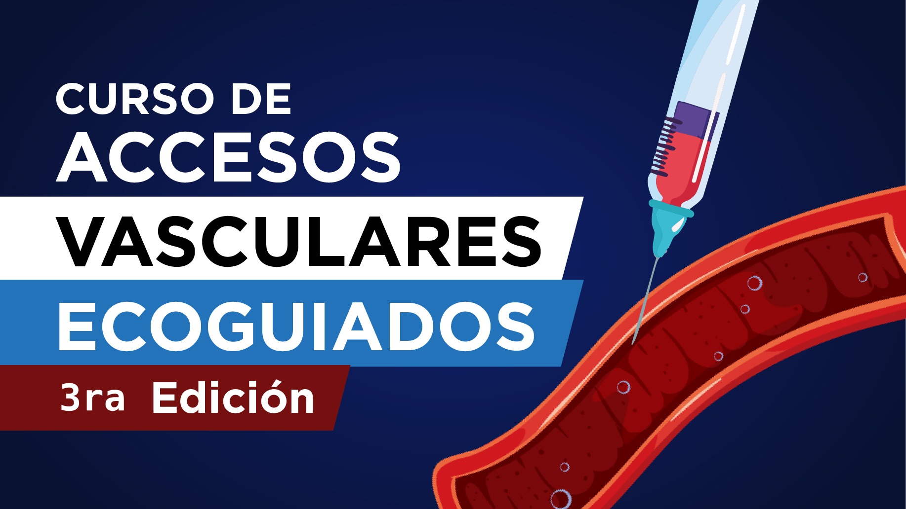 Curso de Accesos Vasculares Ecoguiados (2026sept)